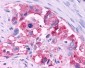 CCR3 Antibody (Extracellular Domain)